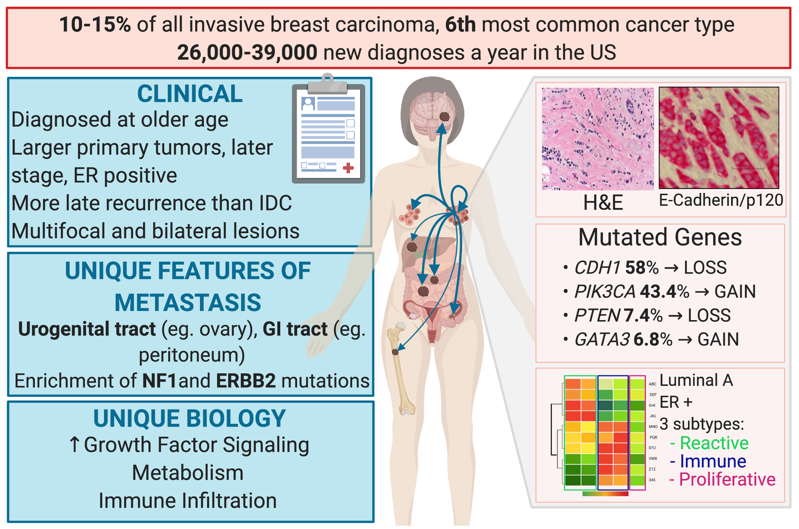 Most Common Breast Cancer Types: Carcinomas