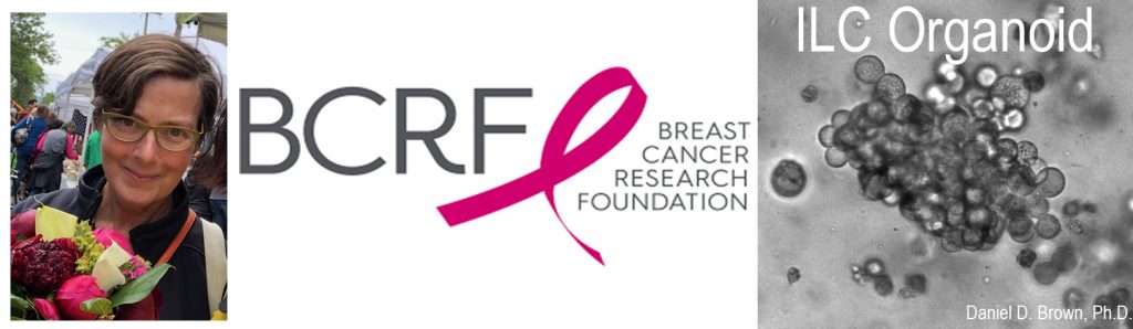 BCRF Legacy Project – An ILC Living Biobank