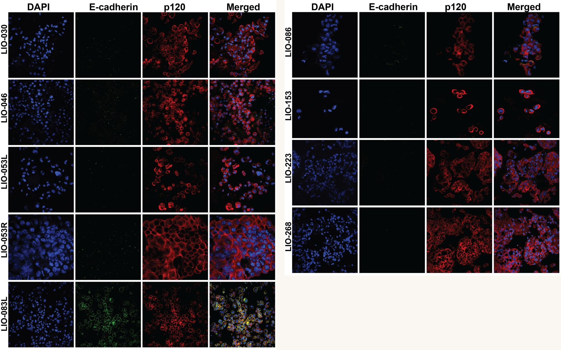 Immunofluorescence for DAPI, E-cadherin, and p120 across all nine Legacy organoid lines, confirming loss of membranous E-cadherin and cytoplasmic p120 redistribution in classical and pleomorphic ILC lines.